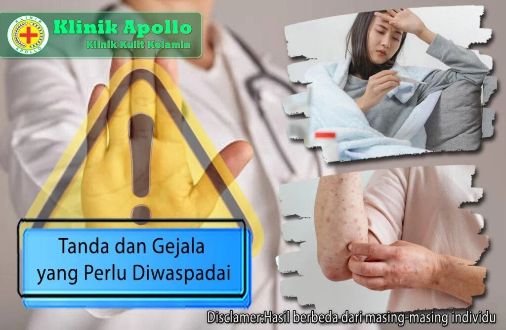 Gejala yang perlu diwaspadai